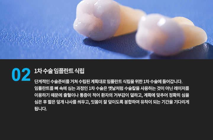 1차 수술 임플란트 식립
단계적인 수술준비를 거쳐 수립된 계획대로 임플란트 식립을 위한 1차 수술에 들어갑니다.
임플란트를 뼈 속에 심는 과정인 1차 수술은 옛날처럼 수술칼을 사용하는 것이 아닌 레이저를 이용하기 때문에 출혈이나 통증이 적어 환자의 거부감이 덜하고, 계획에 맞추어 정확히 심을 심은 후 짧은 덮개 나사를 씌우고, 잇몸이 잘 덮이도록 봉합하여 유착이 되는 기간을 기다리게 됩니다.