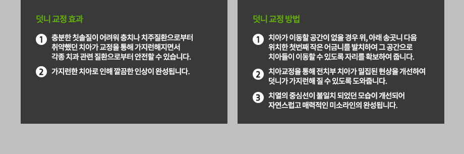 덧니 교정 효과
- 충분한 칫솔질이 어려워 충치나 치주질환으로부터 취약했던 치아가 교정을 통해 가지런해지면서 각종 치과 관련 질환으로부터 안전할 수 있습니다.
-가지런한 치아로 인해 깔끔한 인상이 완성됩니다.
덧니 교정 방법
-치아가 이동할 공간이 없을 경우 위, 아래 송곳니 다음 위치한 첫번째 작은 어금니를 발치하여 그 공간으로 치아들이 이동할 수 있도록 자리를 확보하여 줍니다.
- 치아교정을 통해 전치부 치아가 밀집된 현상을 개선하여 덧니가 가지런해 질 수 있도록 도와줍니다.
-치열의 중심선이 불일치 되었던 모습이 개선되어 자연스럽고 매력적인 미소라인의 완성됩니다.
