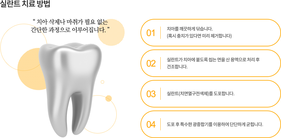 실란트 치료 방법
치아 삭제나 마취가 필요 없는 간단한 과정으로 이루어집니다.
-치아를 깨끗하게 닦습니다. (혹시 충치가 있다면 미리 제거합니다)
-실란트가 치아에 붙도록 씹는 면을 산 용액으로 처리 후 건조합니다.
-실란트(치면열구전색제)를 도포합니다.
-도포 후 특수한 광중합기를 이용하여 단단하게 굳힙니다.